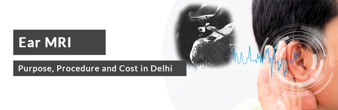 Ear MRI: Purpose, Procedure, Cost in Delhi/ Noida/ NCR